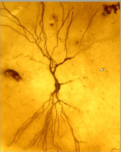 Hippocampal CA3 neuron