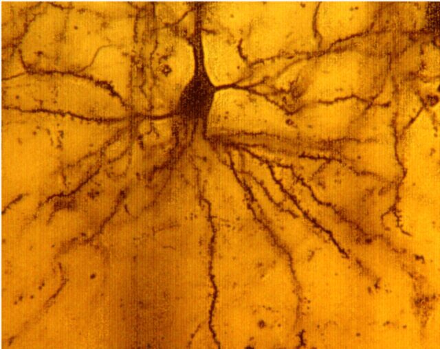 basilar tree