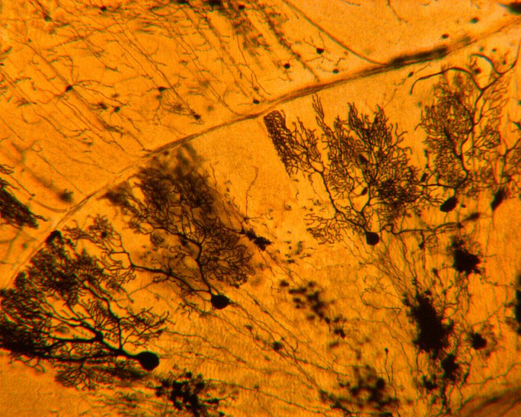 Purkinje Cells of the Cerebellum