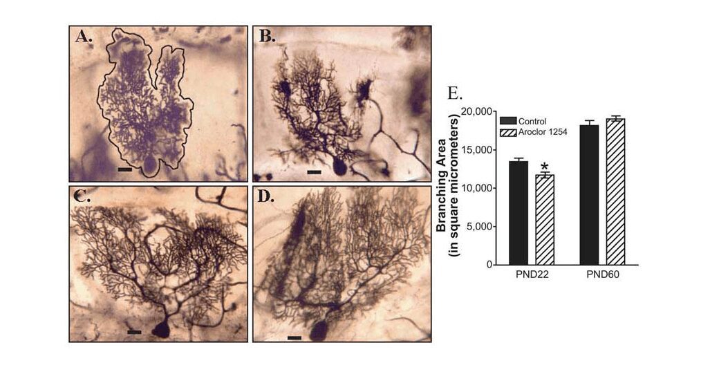 Purkinje cells in Rat Cerebellum