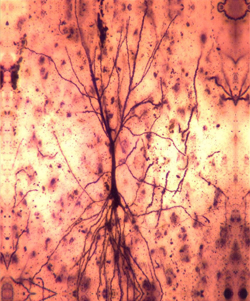 Purkinje Cell dendritic arbor