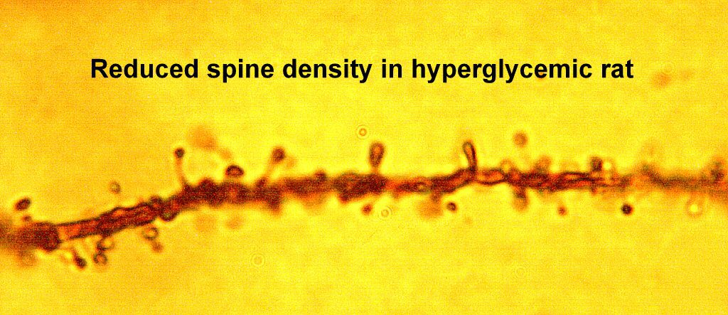 reduced spine desity in hyperglycemic rat
