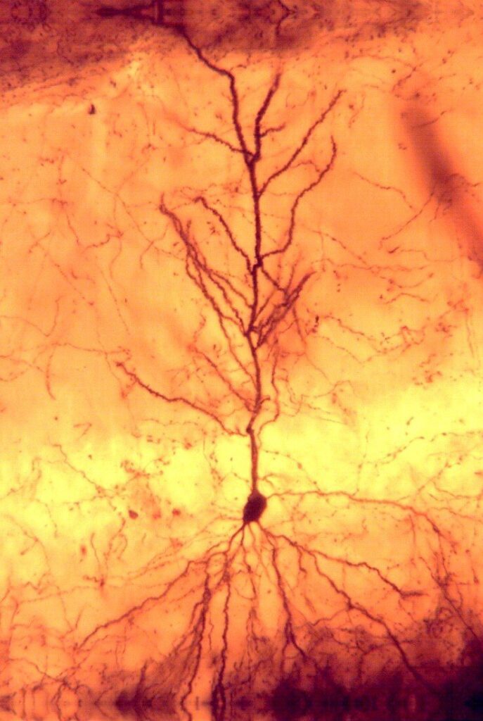 hippocampal CA1 pyramid