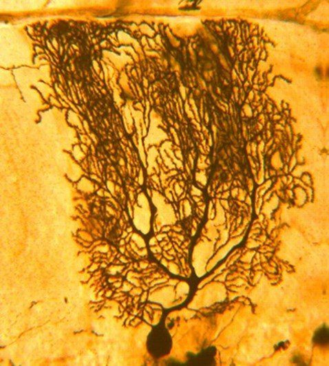 Cerebellar Purkinje Cell