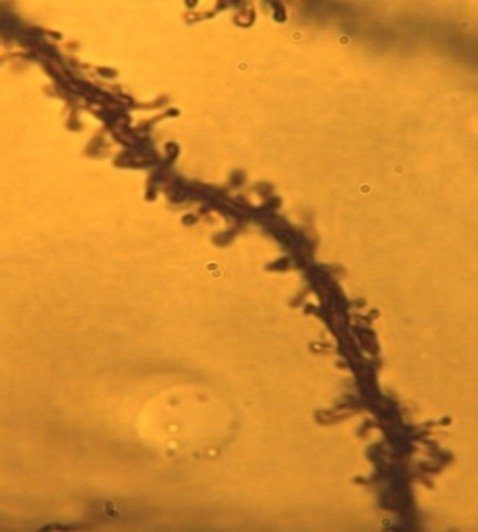 Cortical Dendritic Spines