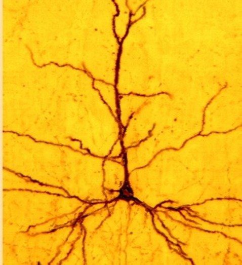 Cortical Pyramid
