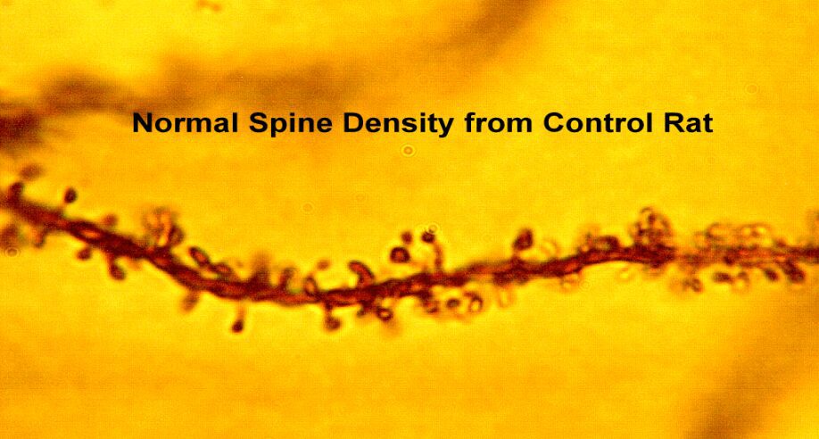 normal spine density from control rat