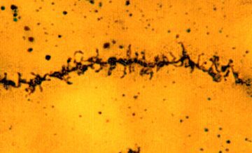 Microscopic image showing neuron dendrites with spines.
